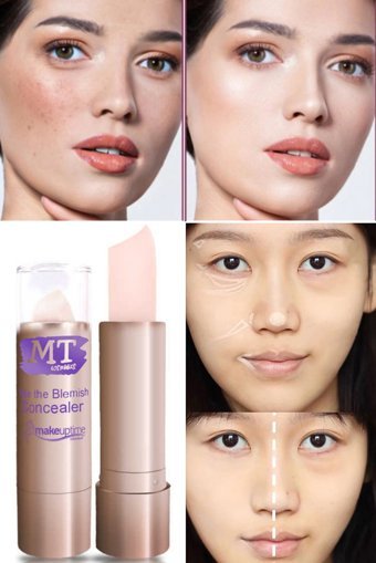 Utelips Ten Rengi Yüz Krem Stick Kapatıcı