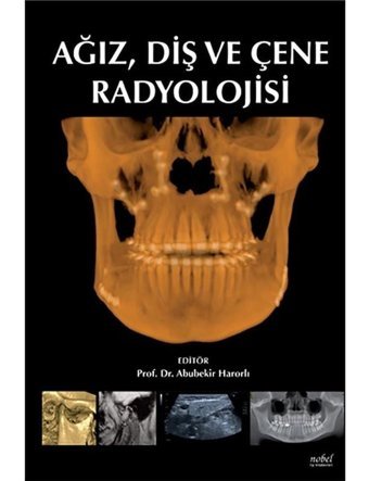 Ağız Diş Ve Çene Radyolojisi- Nobel Tıp Kitabevleri