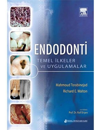 Endodonti Temel İlke ve Uygulamalar- Nobel Tıp Kitabevleri