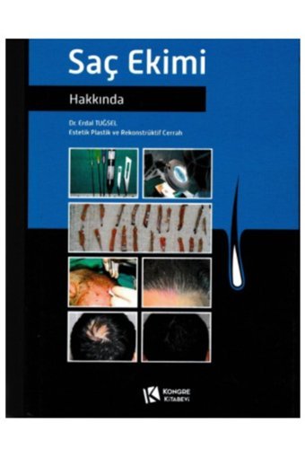 Kongre Kitabevi Saç Ekimi Hakkında
