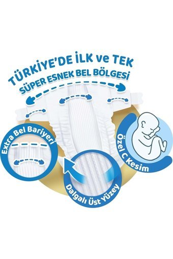 Molfix Pure & Soft Yenidoğan 1 Numara Göbek Oyuntulu Cırtlı Bebek Bezi 160 Adet