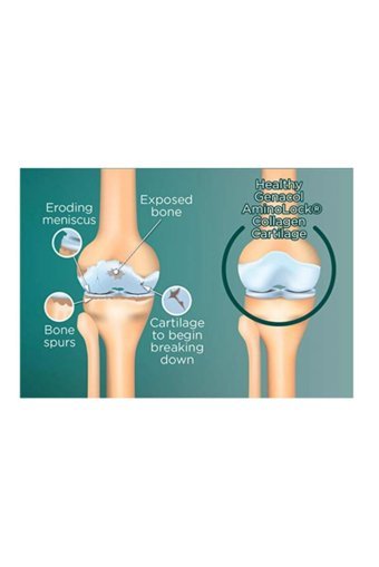 Genacol Plus Glucosamine Aminolock Kapsül Kolajen 90 Kapsül