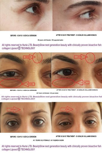 Beautyglow Balık Kaynaklı Aktif Içilebilir Sıvı Kolajen 30x25 ml