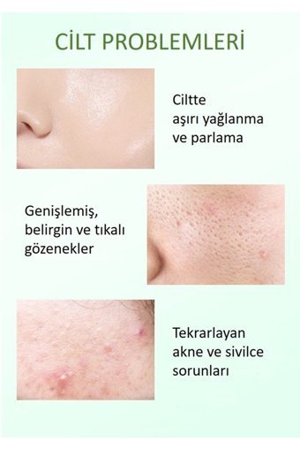 Bioaqua Temperate Nemlendiricili Jel Yüz Maskesi 120 gr