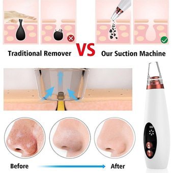 Jessieyou Mall Scrubber Led Ekranlı Şarjlı Vakumlu Siyah Nokta Temizleme Aleti Beyaz