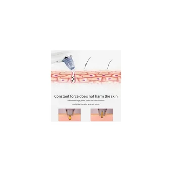 Xinh Blackhead Remover Şarjlı Vakumlu Siyah Nokta Temizleme Aleti Beyaz