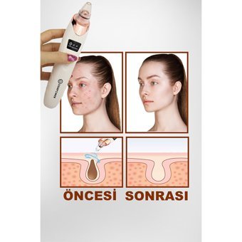 Dem Power 5 Başlıklı Led Ekranlı Şarjlı Vakumlu Siyah Nokta Temizleme Aleti Beyaz