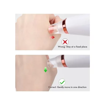 Jessieyou Mall Blackhead Remover Led Ekranlı Şarjlı Vakumlu Siyah Nokta Temizleme Aleti Beyaz