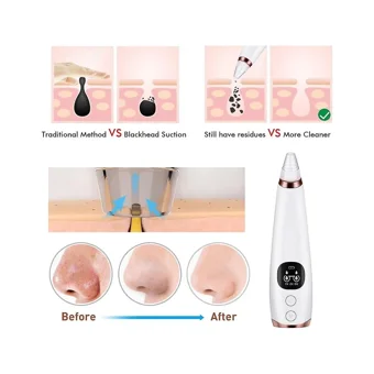 Jessieyou Mall Blackhead Remover Led Ekranlı Şarjlı Vakumlu Siyah Nokta Temizleme Aleti Beyaz