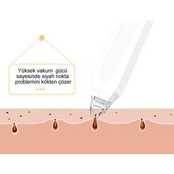 Orazoğlu Led Ekranlı Şarjlı Vakumlu Siyah Nokta Temizleme Aleti Beyaz Gri