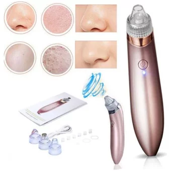 Mobee XN-8030 Şarjlı Vakumlu Siyah Nokta Temizleme Aleti Beyaz Rose