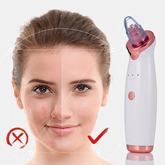 Xinh Blackhead Şarjlı Vakumlu Siyah Nokta Temizleme Aleti Beyaz Pembe