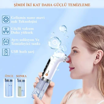 Mi Land Led Ekranlı Buharlı Şarjlı Vakumlu Siyah Nokta Temizleme Aleti Beyaz