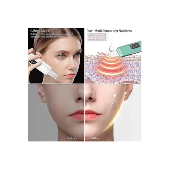 Jessieyou Mall Spatula Blackhead Remover Led Ekranlı Şarjlı Vakumlu Siyah Nokta Temizleme Aleti Mor