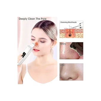 Jessieyou Mall Spatula Blackhead Remover Led Ekranlı Şarjlı Vakumlu Siyah Nokta Temizleme Aleti Mor
