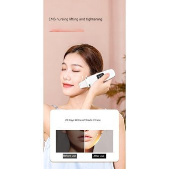 Joyne Brighten Dirt Led Ekranlı Şarjlı Vakumlu Siyah Nokta Temizleme Aleti Beyaz