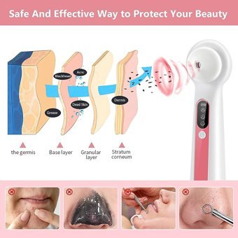 Jarke Led Ekranlı Şarjlı Vakumlu Siyah Nokta Temizleme Aleti Beyaz Pembe