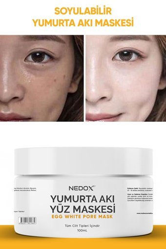 Nedox Nemlendiricili Soyulabilir Krem Yüz Maskesi 100 ml