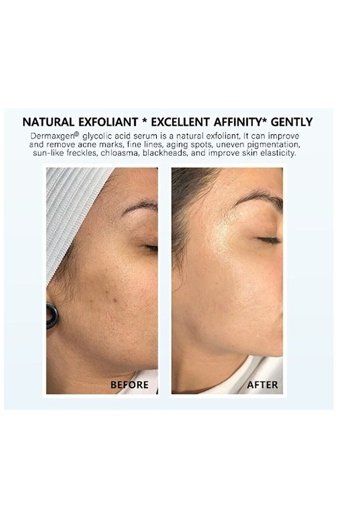Lima Glikolik Asit %40 Serum Şişe Yüz Peelingi 30 ml