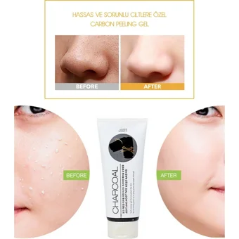 Jigott Charcoal Jel Tüp Yüz Peelingi 180 ml
