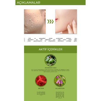 Tenzero Leke Giderici Jel Tüp Yüz Peelingi 180 ml