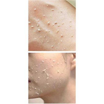 Mc Beautylab Leke Giderici Sıkılaştırıcı Jel Şişe Yüz Peelingi 75 ml