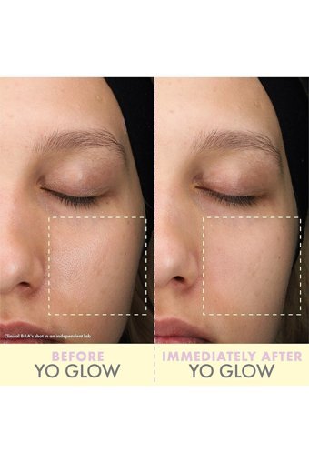 Wishful Yo Glow Jel Tüp Yüz Peelingi 40 ml