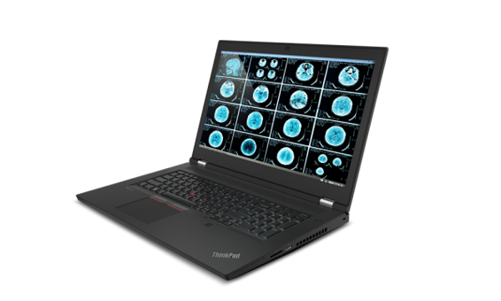 Lenovo ThinkPad P17 (G2) 20YU0023TX016 Harici RTX A2000 Ekran Kartlı Intel Core i7 11800H 128 GB Ram DDR4 512 GB SSD 17.3 inç FHD Windows 10 Pro Laptop